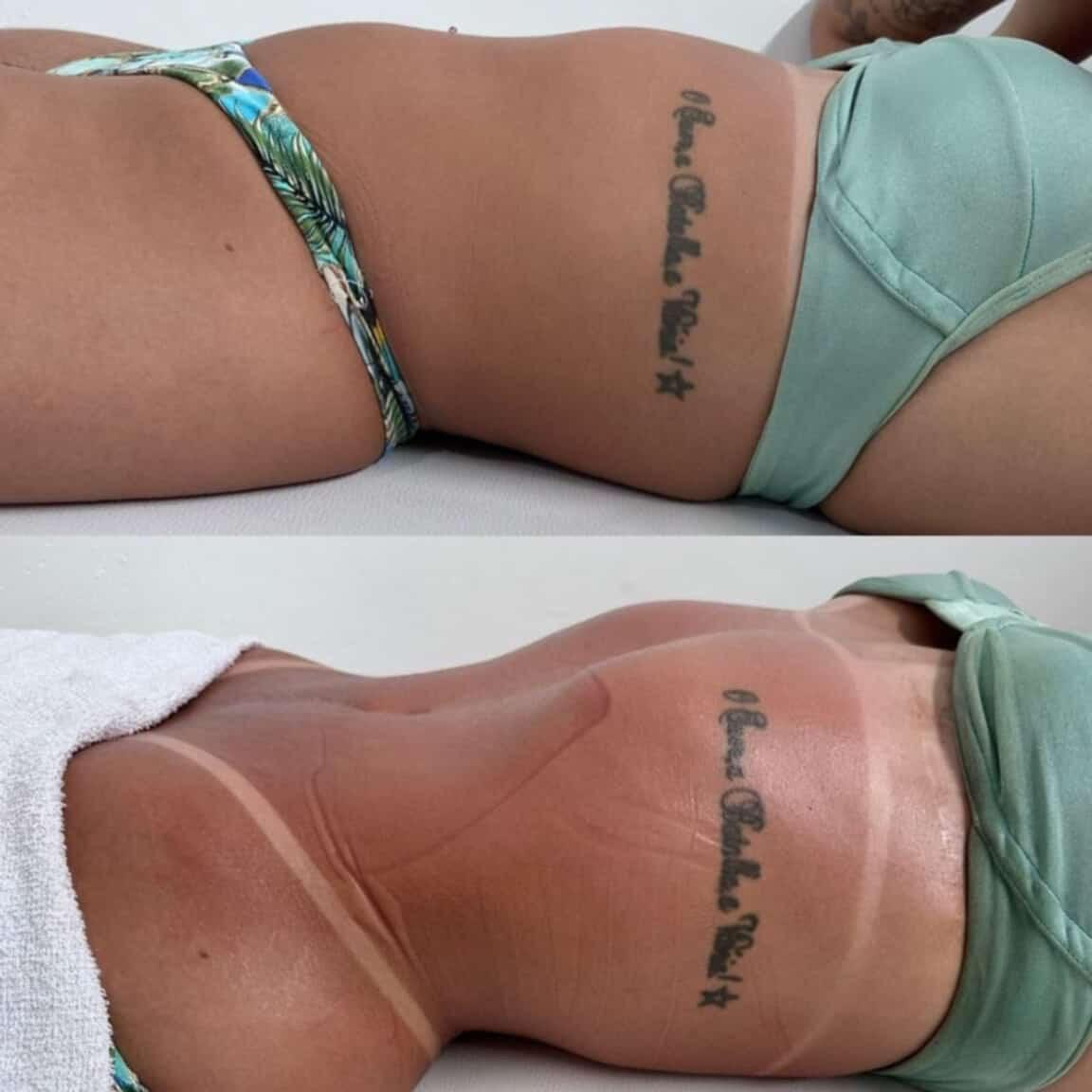 Redução de medidas — antes e depois