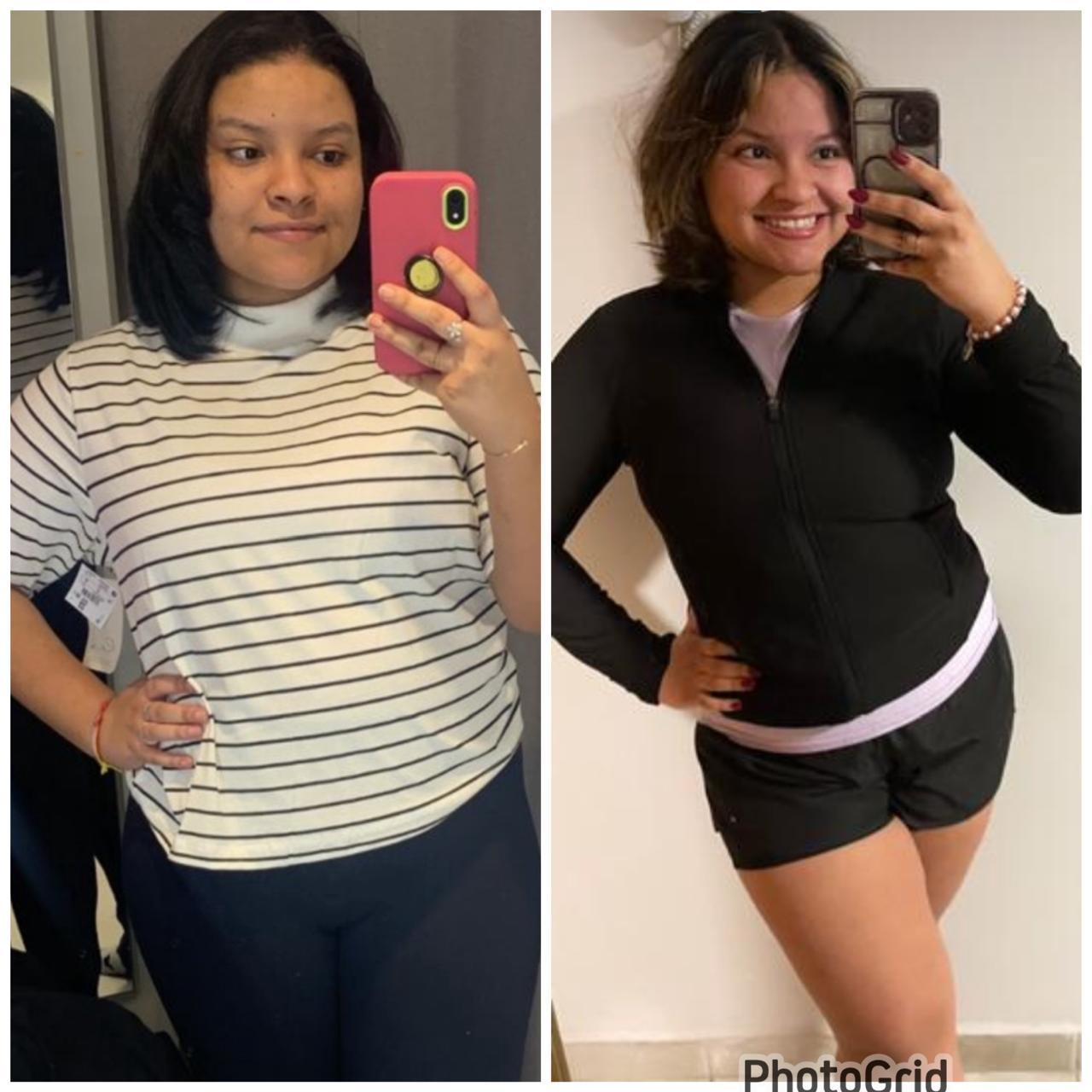 Reeducação corporal — antes e depois