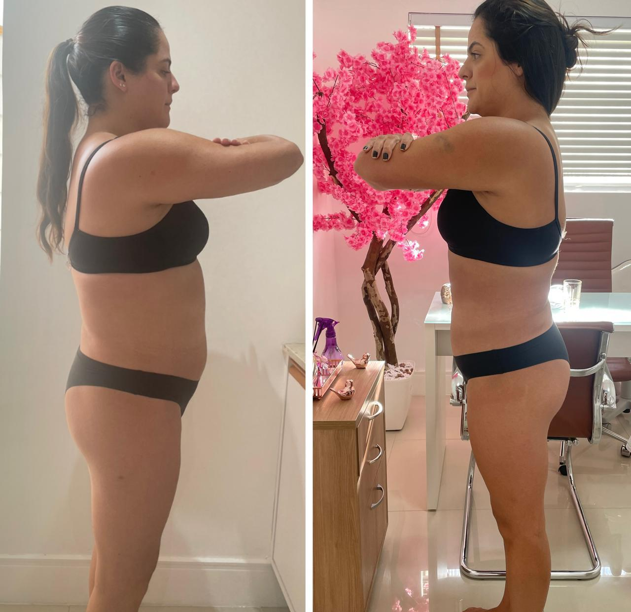 Emagrecimento integrativo — antes e depois